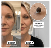 SKINFIX — 2