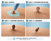 SKINFIX — 3