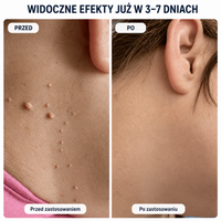 SKINFIX — 6